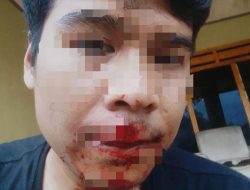 Pemilik Perusahan Media Sidik Berita.Com Cekcok Berujung Pengeroyokan, Korban Menuntut Pelaku Keranah Hukum